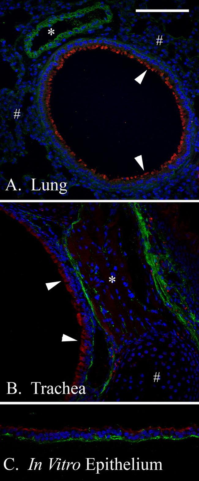 KDEL Antibody in Immunocytochemistry, Immunohistochemistry (ICC/IF, IHC)