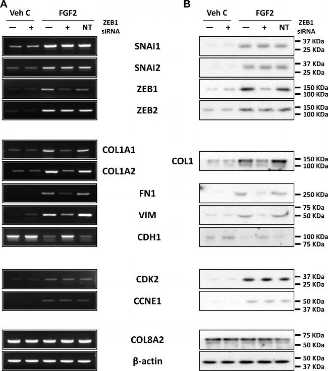 ZEB1 Antibody in Western Blot (WB)