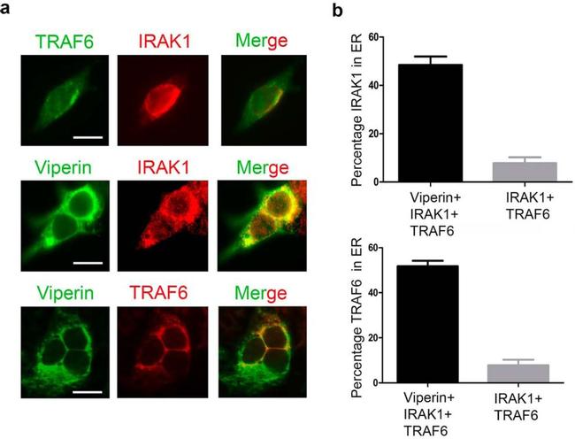 IRAK1 Antibody in Immunocytochemistry (ICC/IF)