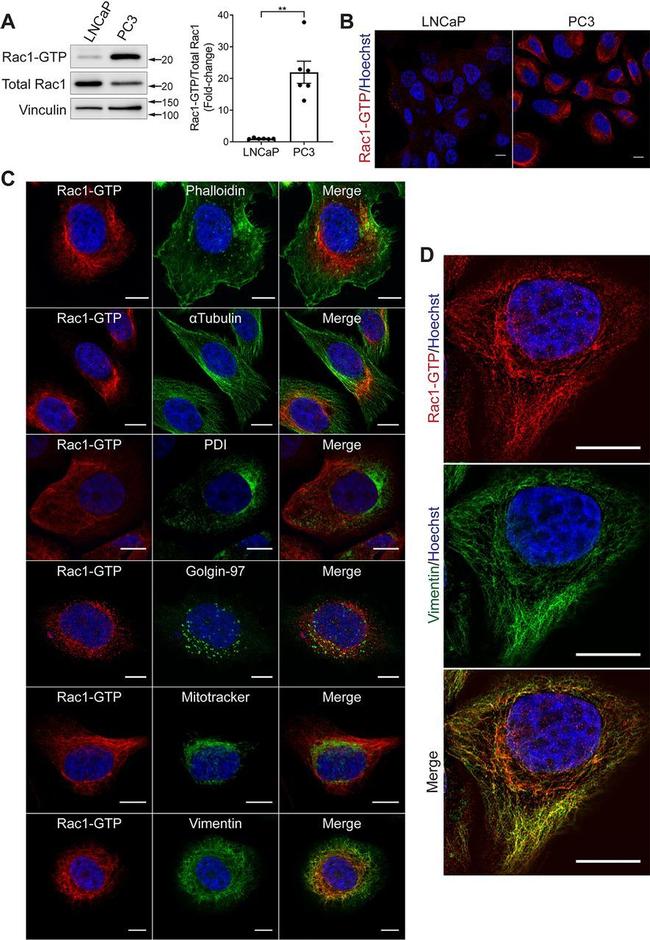 Golgin-97 Antibody in Immunocytochemistry (ICC/IF)