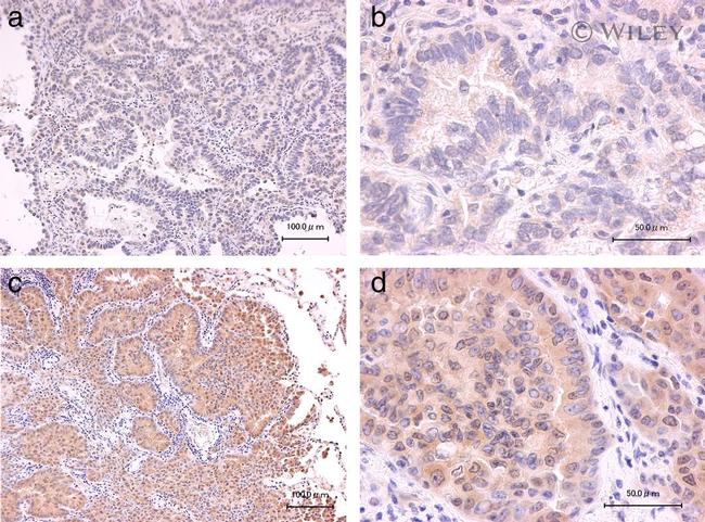 MOB1 Antibody in Immunohistochemistry (IHC)