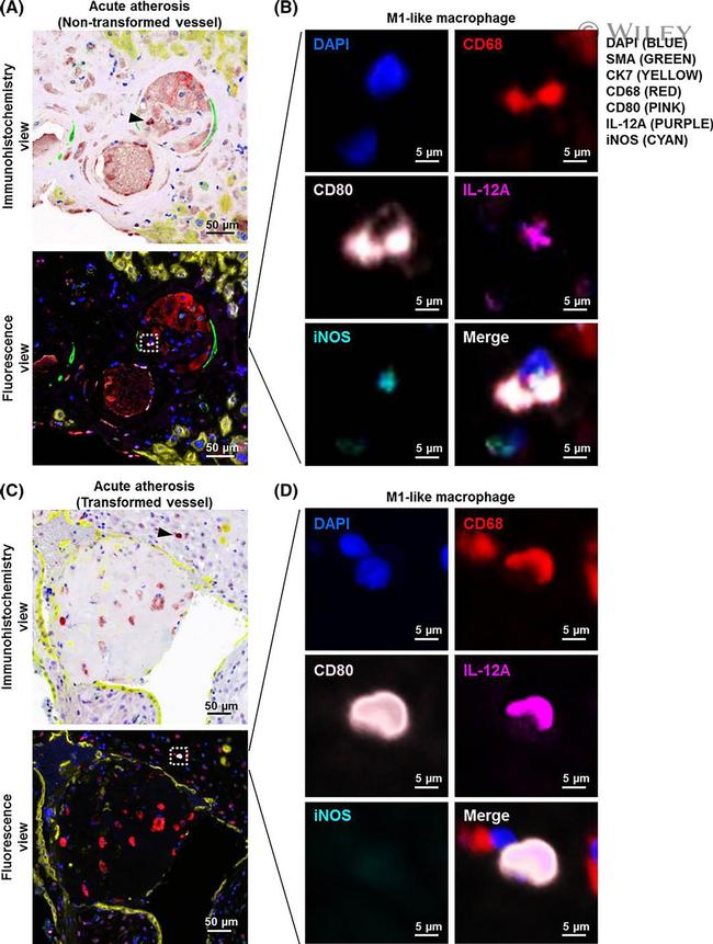 iNOS Antibody in Immunohistochemistry (IHC)