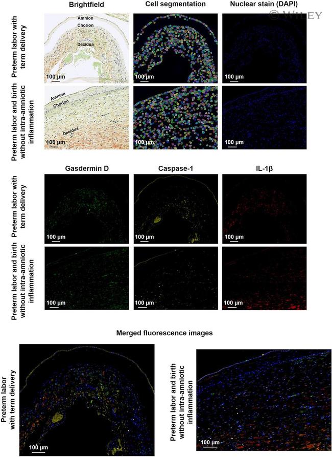 Caspase 1 Antibody in Immunohistochemistry (IHC)