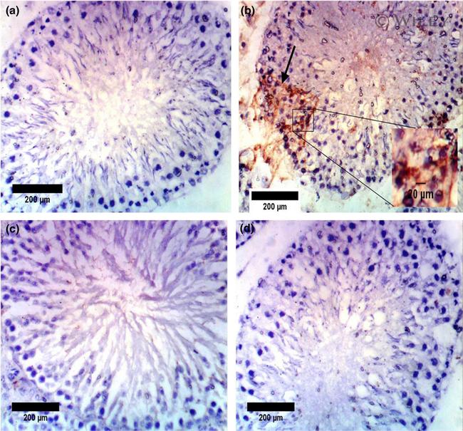 Caspase 3 Antibody in Immunohistochemistry (IHC)