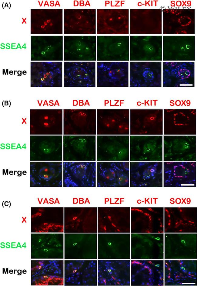 PLZF Antibody in Immunohistochemistry (IHC)