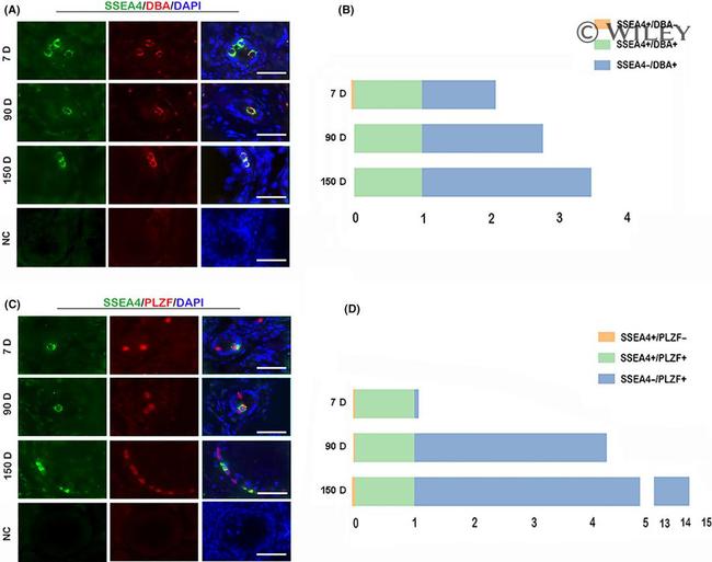 PLZF Antibody in Immunohistochemistry (IHC)