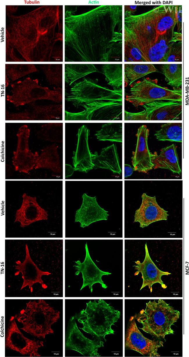 beta Tubulin Antibody in Immunocytochemistry (ICC/IF)