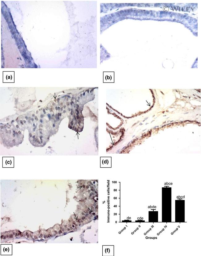 Active Caspase 3 Antibody in Immunohistochemistry (IHC)