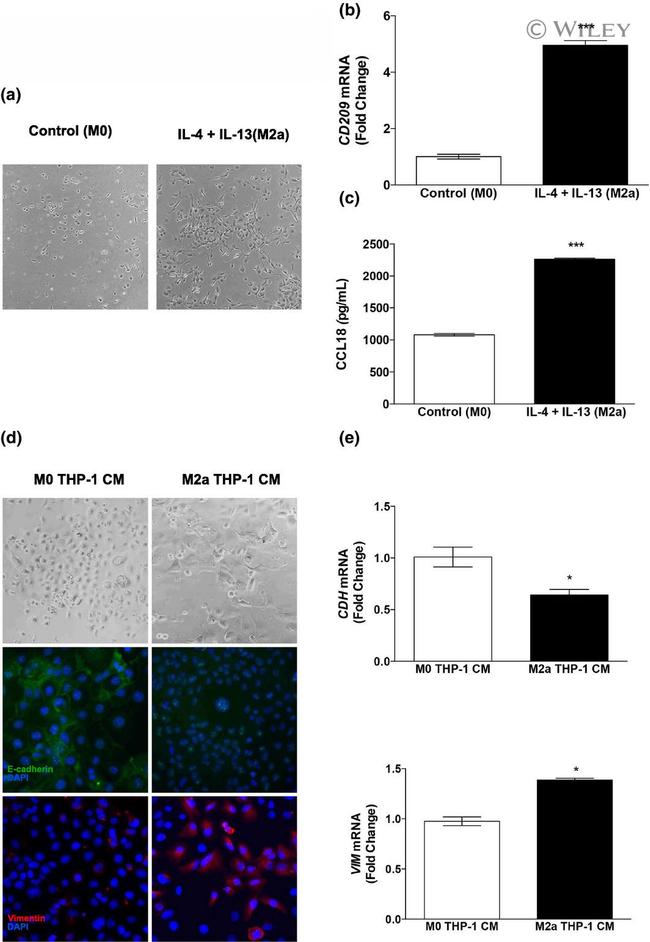 E-cadherin Antibody in Immunocytochemistry (ICC/IF)