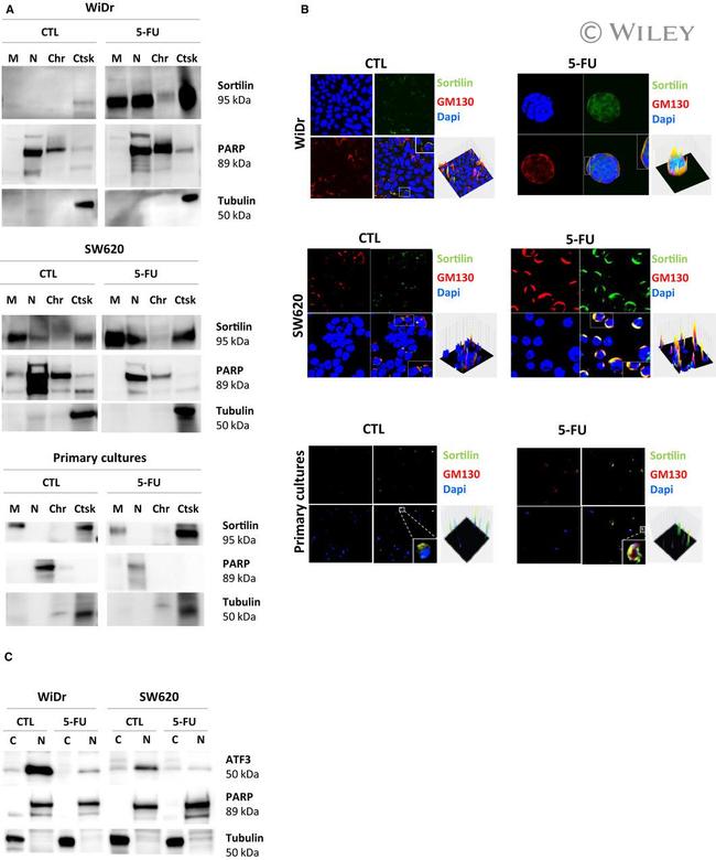 GM130 Antibody in Immunocytochemistry (ICC/IF)