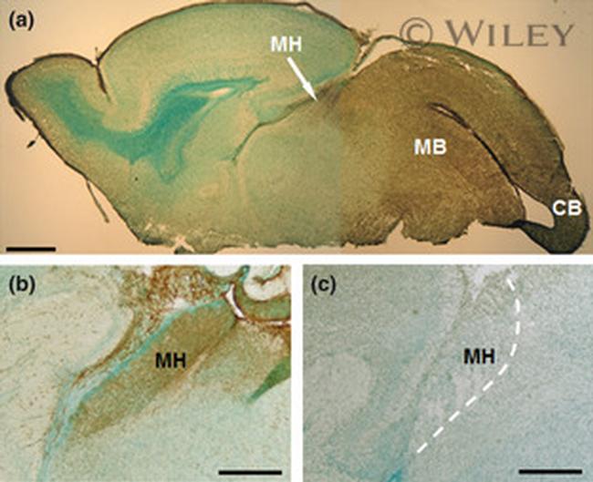 beta Galactosidase Antibody in Immunohistochemistry (IHC)