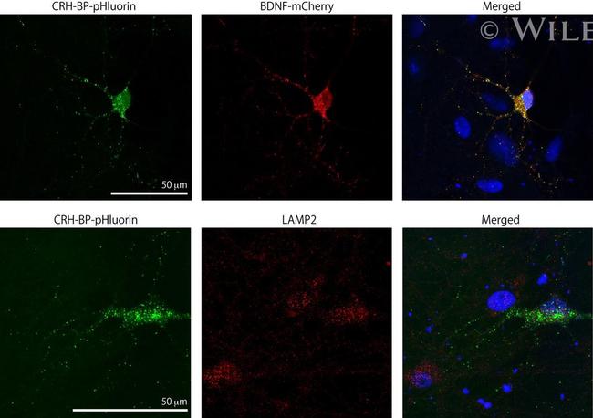 LAMP2 Antibody in Immunocytochemistry (ICC/IF)