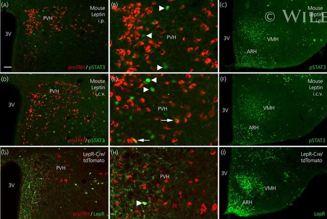 TRH Antibody in Immunohistochemistry (IHC)