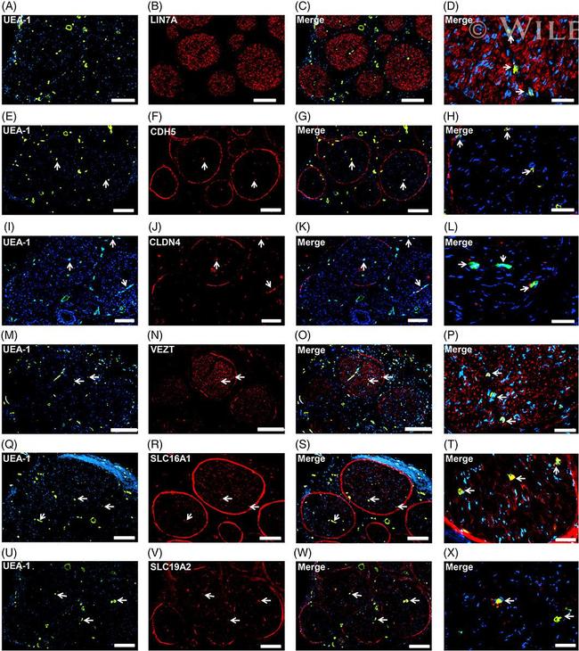 Claudin 4 Antibody in Immunohistochemistry (IHC)