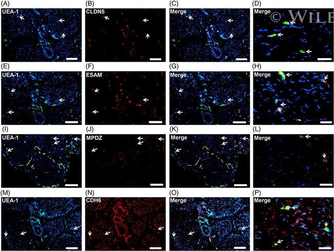 K-cadherin Antibody in Immunohistochemistry (IHC)