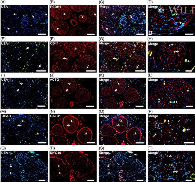 gamma Actin Antibody in Immunohistochemistry (Frozen) (IHC (F))