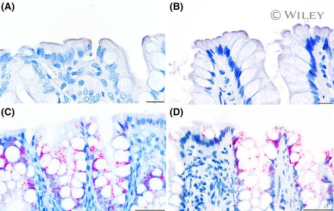 SLC10A2 Antibody in Immunohistochemistry (IHC)