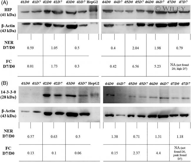 14-3-3 theta Antibody in Western Blot (WB)