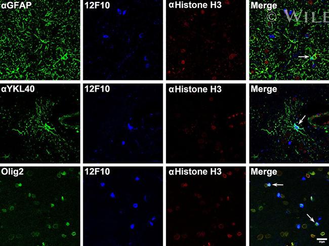 CHI3L1 Antibody in Immunohistochemistry (IHC)