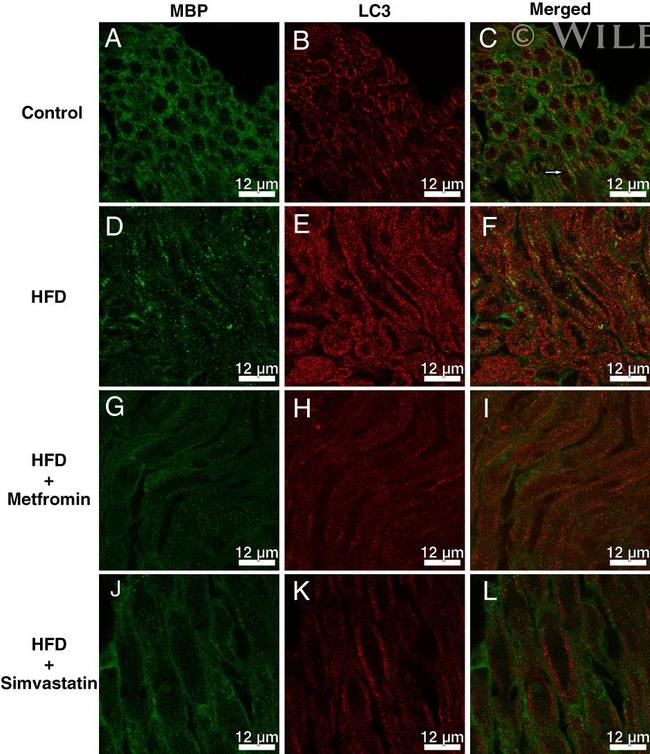 MBP Antibody in Immunohistochemistry (IHC)