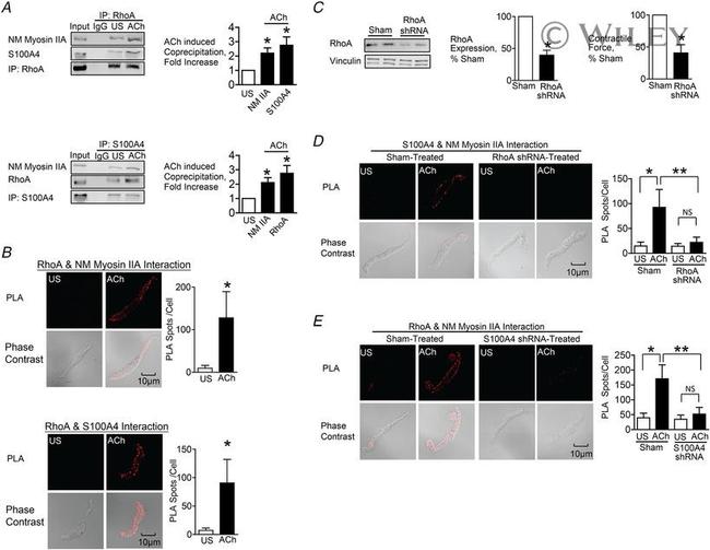 RhoA Antibody in Western Blot, Immunoprecipitation (WB, IP)