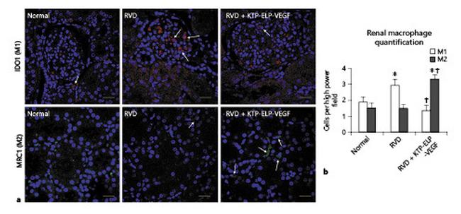 IDO Antibody in Immunohistochemistry (IHC)