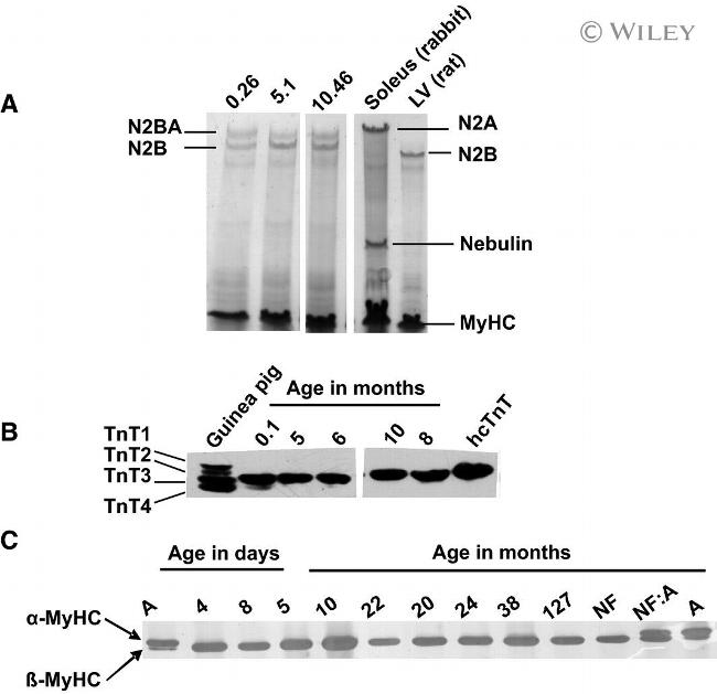 Cardiac Troponin T Antibody in Western Blot (WB)