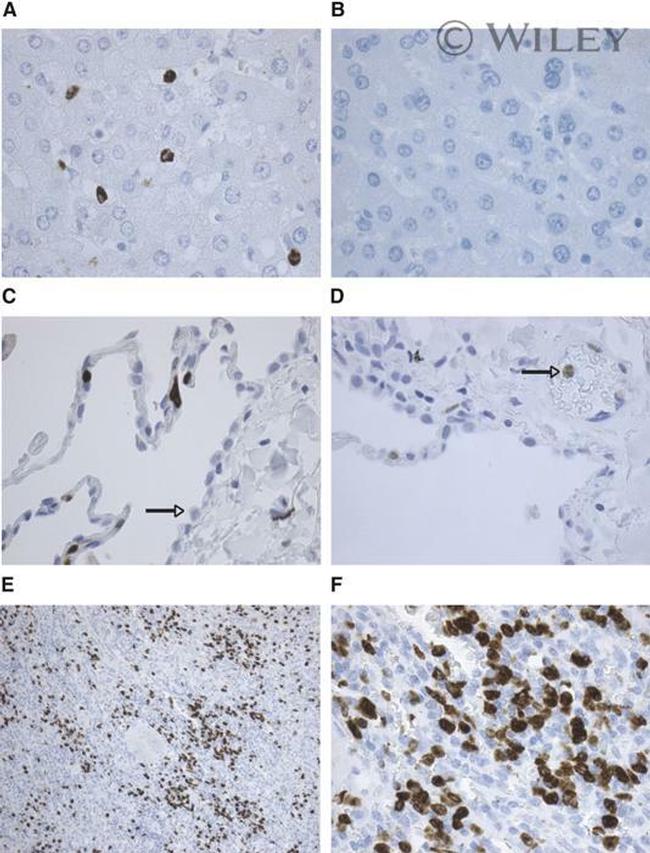 FCN1 Antibody in Immunohistochemistry (IHC)