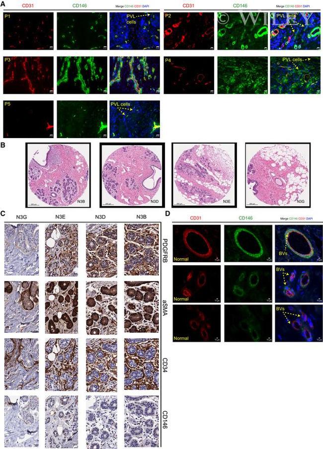 CD34 Antibody in Immunohistochemistry (IHC)