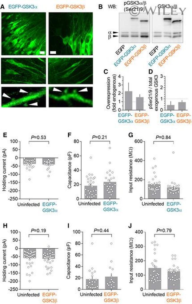 GSK3 alpha/beta Antibody in Western Blot (WB)