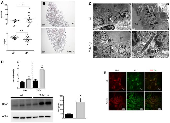 KDEL Antibody in Immunohistochemistry (IHC)