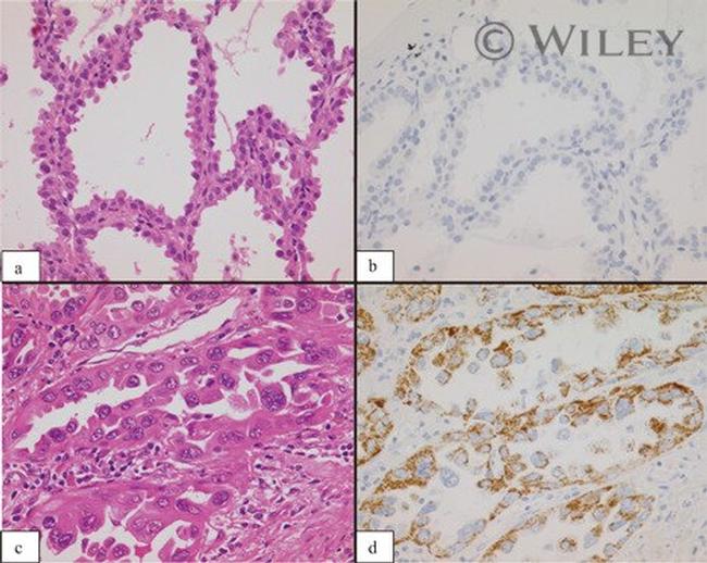 OCIAD2 Antibody in Immunohistochemistry (IHC)