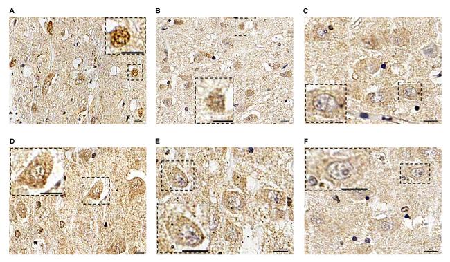 CDK1 Antibody in Immunohistochemistry (IHC)