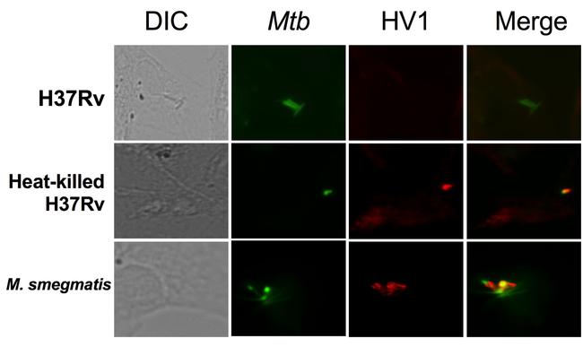 HVCN1 Antibody in Immunocytochemistry (ICC/IF)