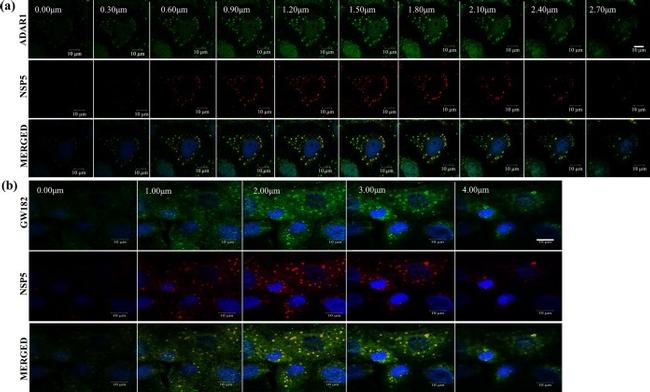 ADAR Antibody in Immunocytochemistry (ICC/IF)