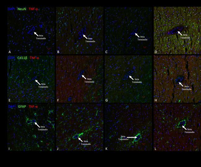 GFAP Antibody in Immunocytochemistry (ICC/IF)