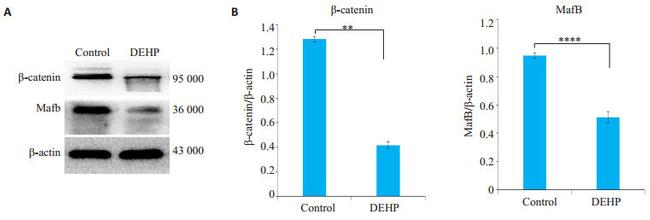 beta Catenin Antibody in Western Blot (WB)