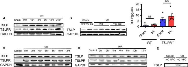 TSLP Antibody in Western Blot (WB)