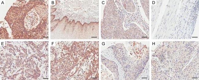 Occludin Antibody in Immunohistochemistry (IHC)