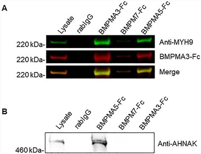 AHNAK Antibody in Western Blot (WB)