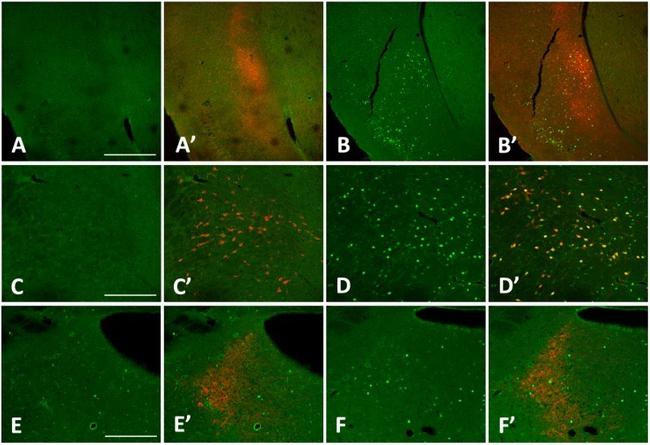 Latexin Antibody in Immunocytochemistry, Immunohistochemistry (ICC/IF, IHC)