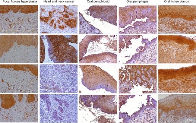 CXCR4 Antibody in Immunohistochemistry (IHC)