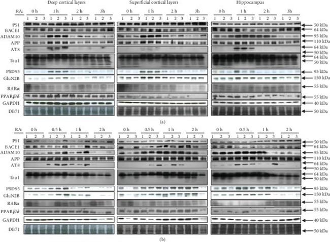 PSD-95 Antibody in Western Blot (WB)