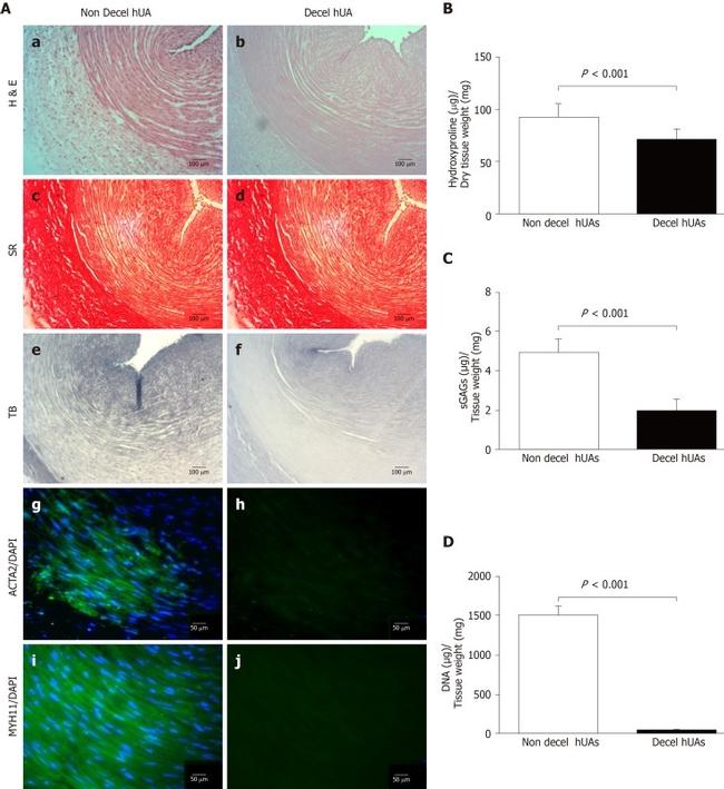 Actin Antibody in Immunohistochemistry (IHC)