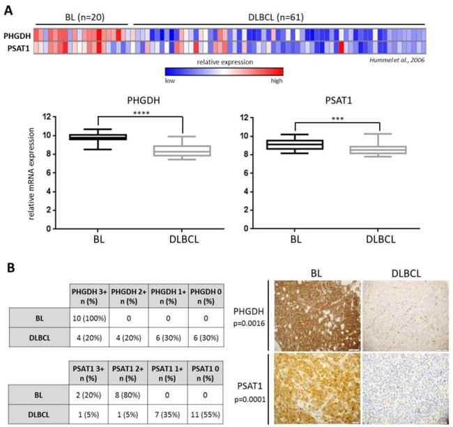 PSAT1 Antibody in Immunohistochemistry (IHC)