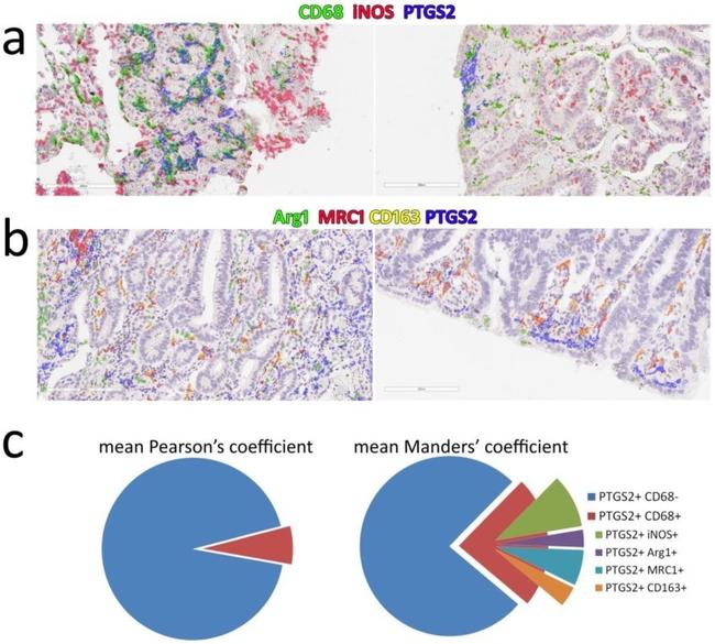 iNOS Antibody in Immunohistochemistry (IHC)