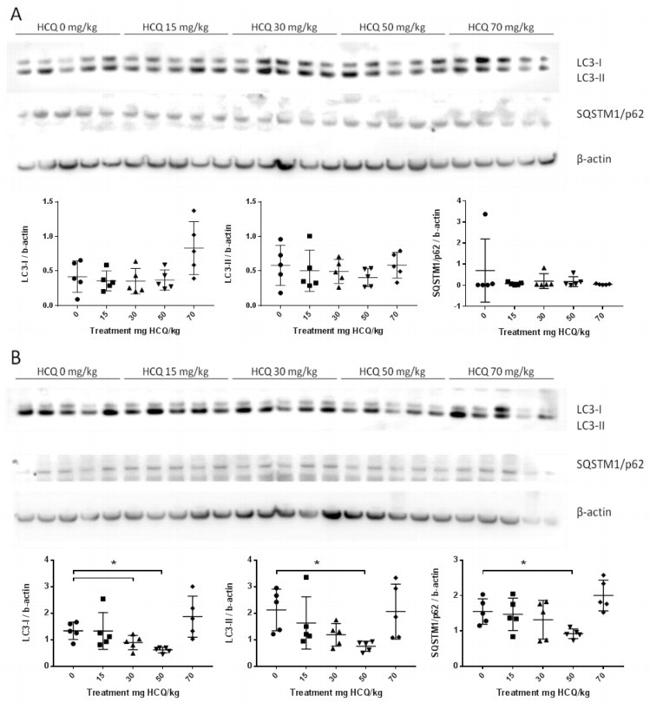 LC3B Antibody in Western Blot (WB)