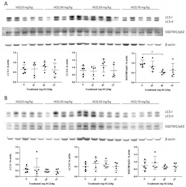 LC3B Antibody in Western Blot (WB)