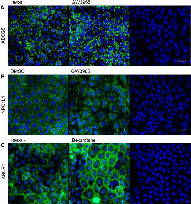 NPC1L1 Antibody in Immunocytochemistry (ICC/IF)