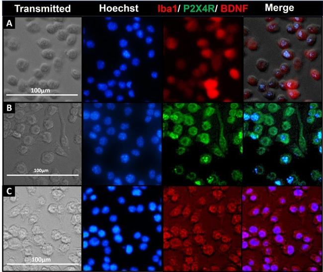 BDNF Antibody in Immunocytochemistry (ICC/IF)